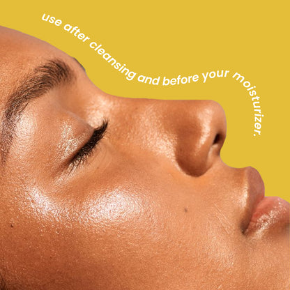 Absolut Skin | Radiance Serum Absolut Skin