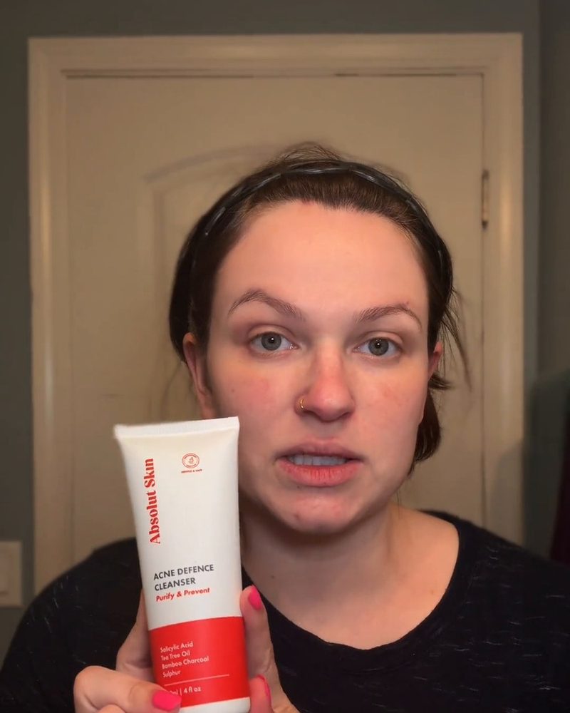 Creator using Absolut Skin acne line